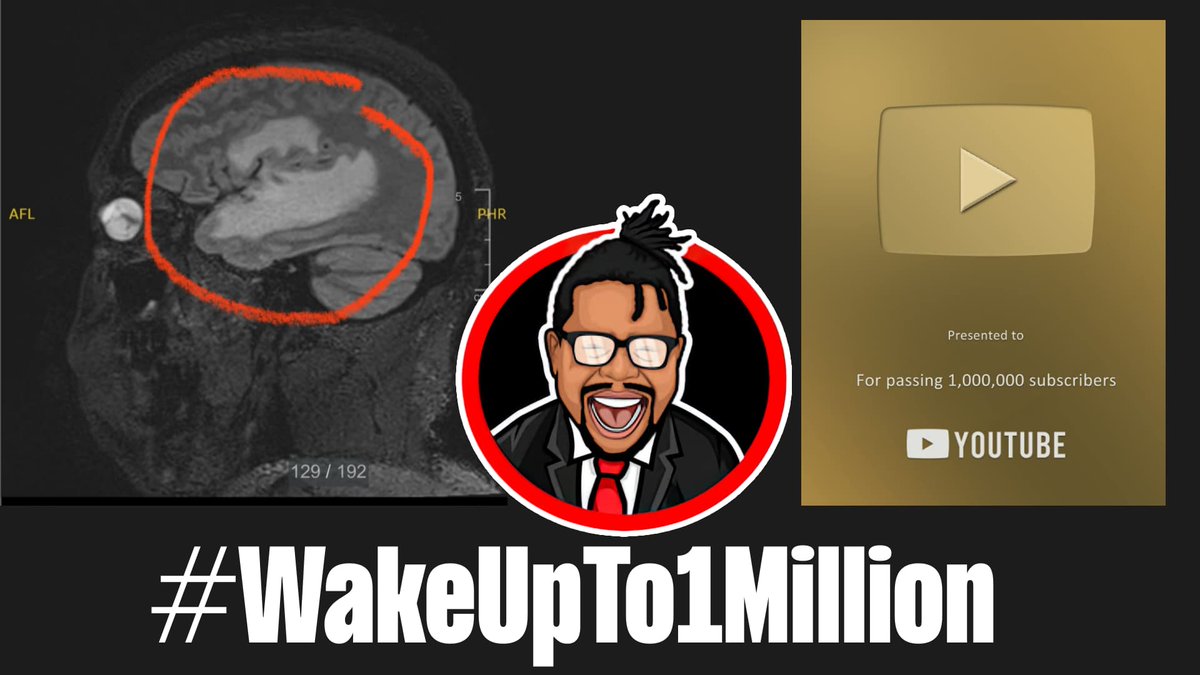 hunleyeric's tweet image. Hey all, @NatetheLawyer is going into brain surgery soon! 

This is terrifying but we can motivate his recovery.

Please join us and help Nate #WakeUpTo1Million subs!

youtube.com/@NateTheLawyer…
