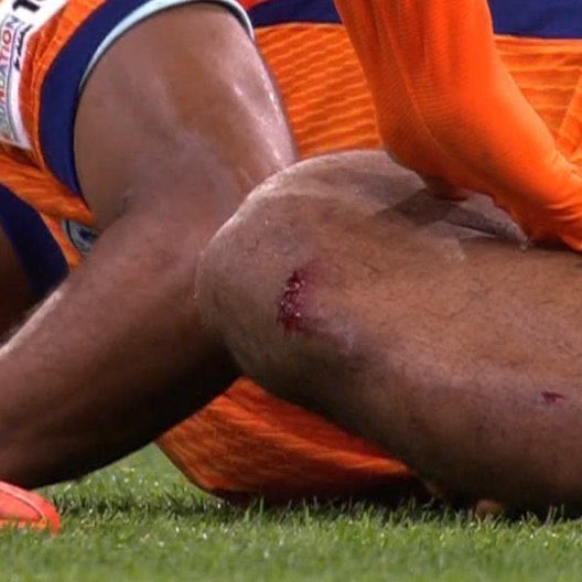 AFC_Capital's tweet image. 🚨 تعرض جوريين تيمبر ليلة الأمس إلى ضربة قوية اعلى الساق منتصف الركبة خلال مواجهة ليتوانيا — تم استبدال اللاعب بالدقيقة 64 من المباراة 

— لا وجود تحديثات حول مدى خطورة الاصابة