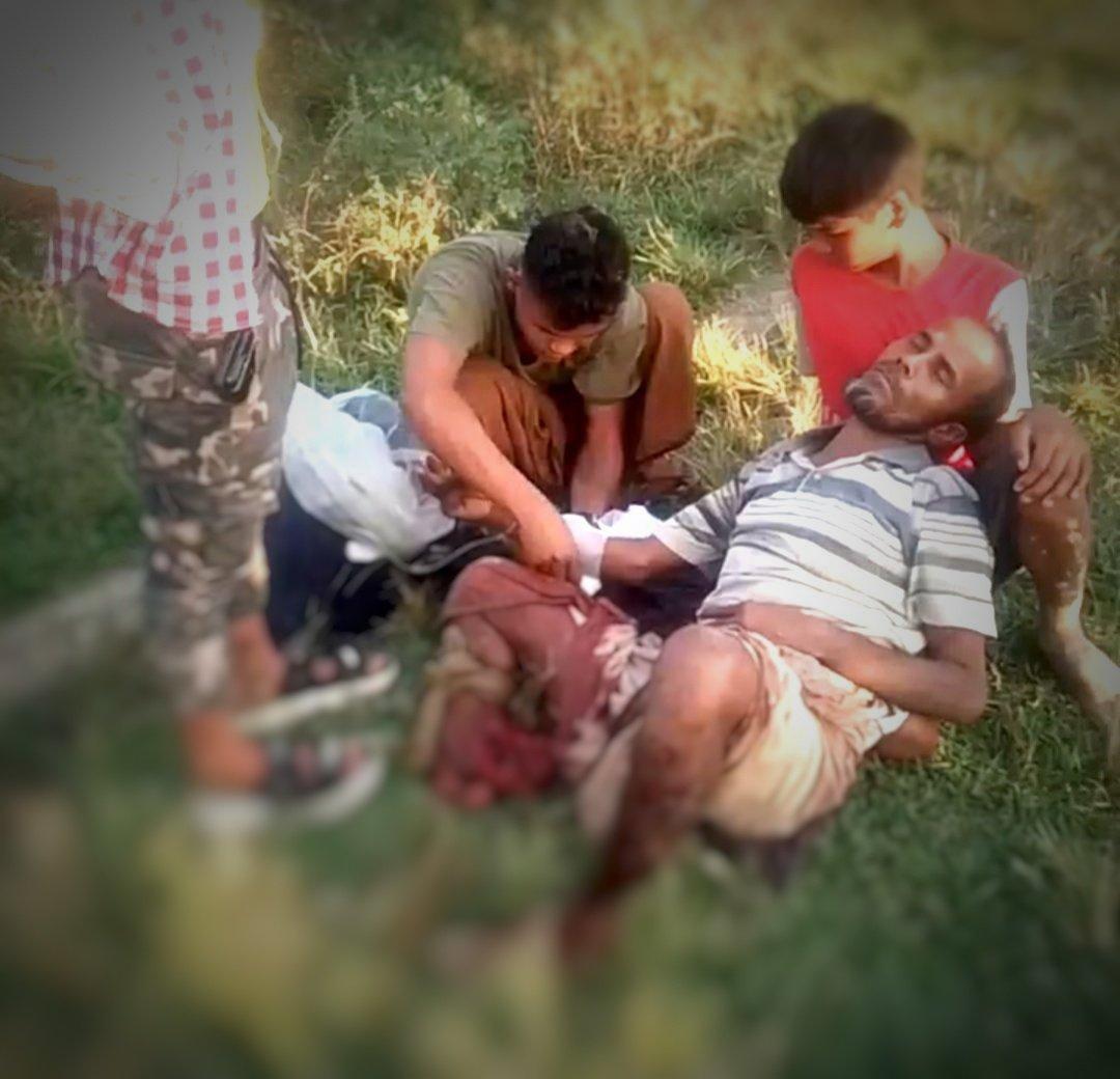 SRsuhelrana's tweet image. A #Rohingya man, Abula Shim (55) from Gan Chaung North Village, in Maungdaw township, was severely injured after stepping on a landmine allegedly planted by the Buddhist AA terrorists at around 4:00 PM on Nov 17.

The blast severed his right leg and badly injured his left leg