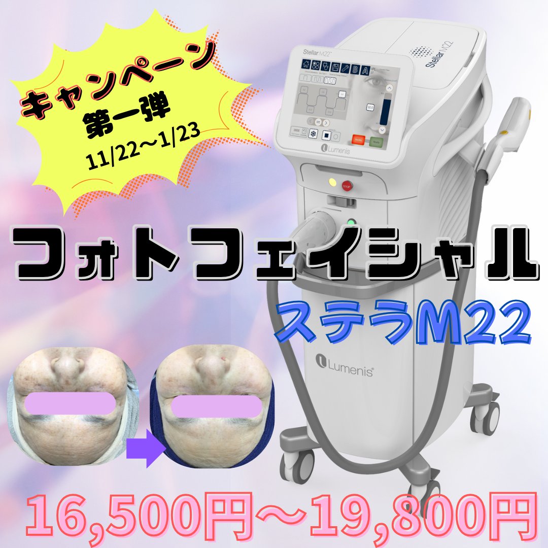 11/22(金)〜1/23(金)キャンペーン開催✨ #フォトフェイシャル #M22