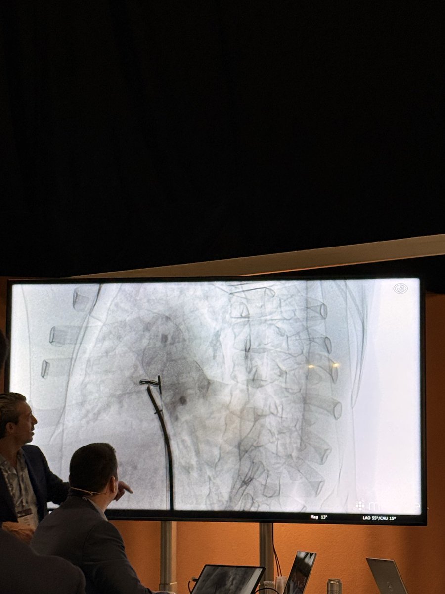 BenekiEirini's tweet image. #PCRLV 

Good morning ☀️ 

Happening now at Imaging Learning Lab!

#ICE for #tricuspid valve interventions 

@nicolo_piazza 

@PCRonline @PamelaGatto @DrGarot @drtsakamoto @dr_chrisallen @juliendreyfus1 @alcantaramonica @MiChen__ @CurioJonathan @TagliariPaula @jcecharte