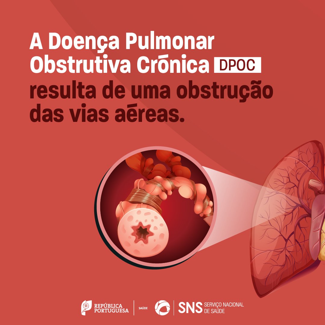 SNS_Portugal's tweet photo. Sabia que o fumo dos cigarros é a principal causa da Doença Pulmonar Obstrutiva Crónica (DPOC)? Proteja-se! #Saúde #SNS #DoençaPulmonarObstrutivaCrónia #DPOC
©👉 Sociedade Portuguesa de Pneumologia https://t.co/tFYjfFUOpk
