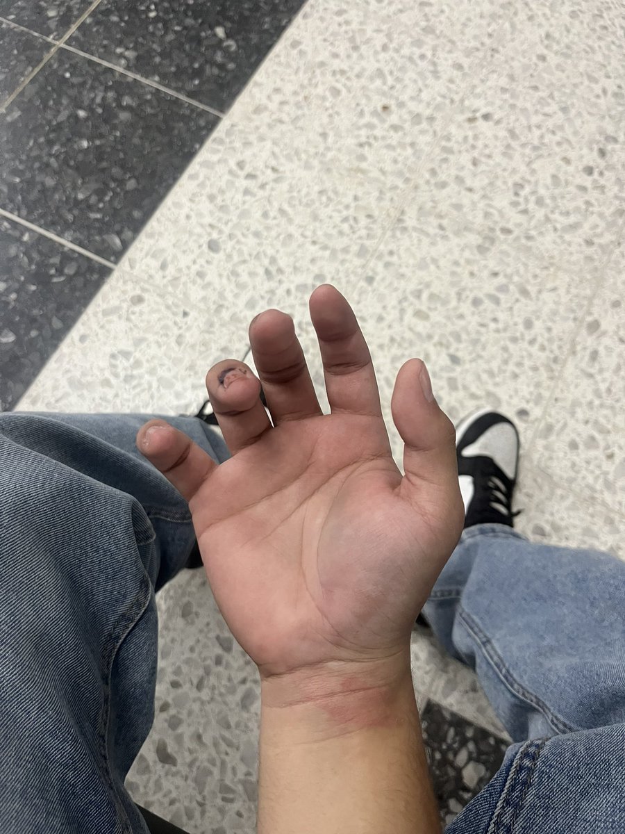 Es la tercera vez en dos meses que me toca estar viniendo al hospi