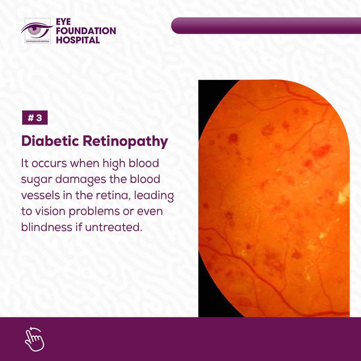 eyefoundationng's tweet photo. Additionally, you can book your appointment by calling +234 201 454 0792 or sending a WhatsApp message to 0905 047 1995. #diabeticeyedisease #diabetesawareness #diabetesandvision #protectyoursight #diabetes #eyecarefirst #diabetescare #visionmatters #eyehealth #healthyvision https://t.co/doO9Fg3jq4