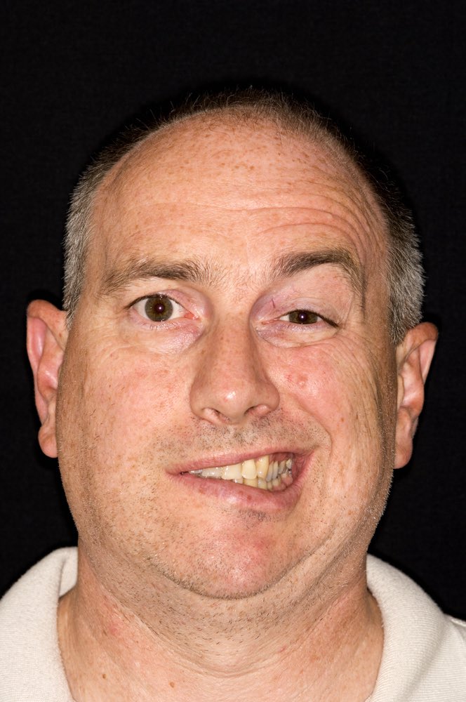 يكثر هذه الأيام في فصل الشتاء،
مرض #ابو_وجه
أو #التهاب_العصب_السابع

يا ترى ما هو السبب ؟
و كيفية العلاج ؟

حياكم نتعرف 👇