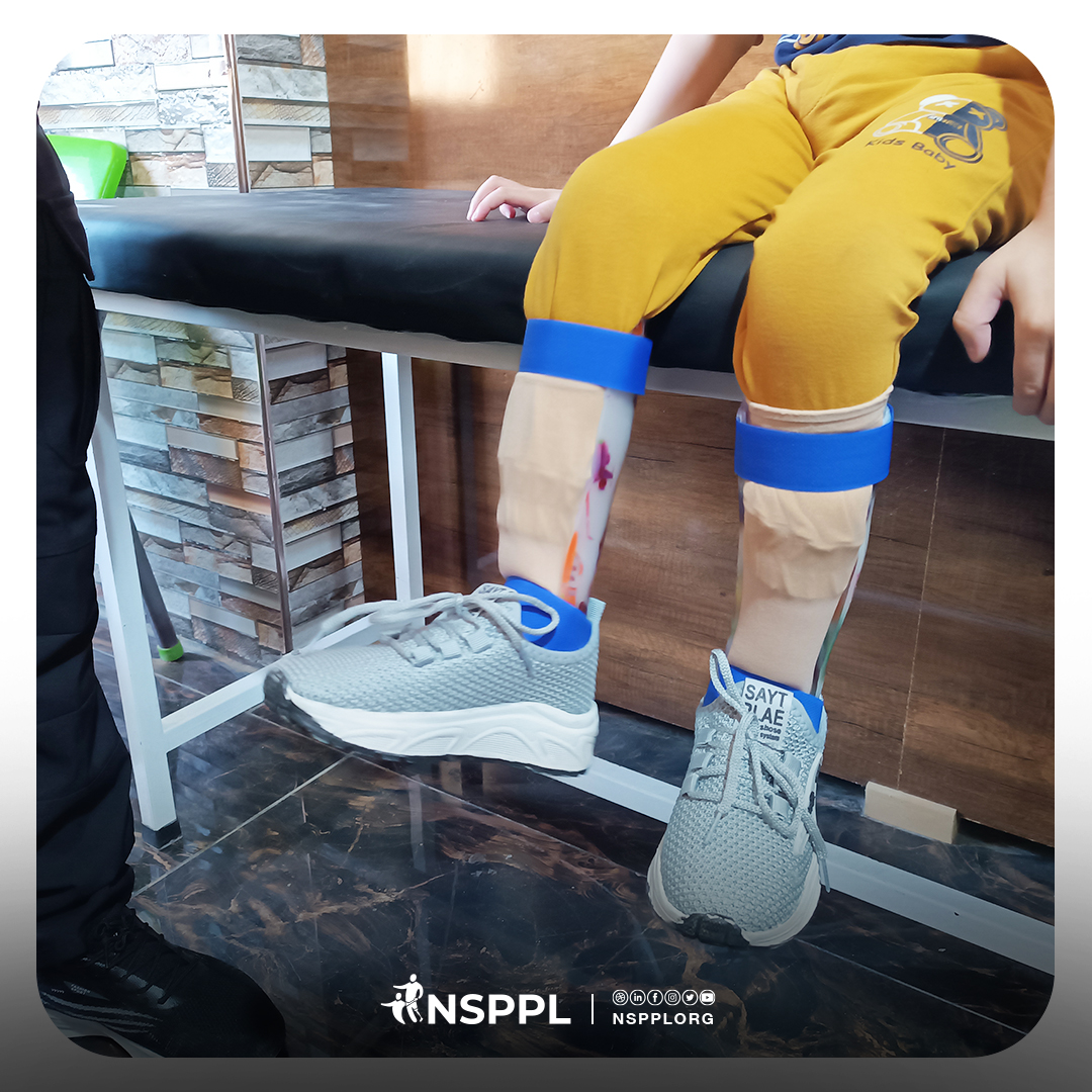 NSPPLORG's tweet image. With regular use and training, the device is expected to improve Imad’s daily mobility and help him regain his activity as a child eager to play and continue his life normally.  

#NSPPL #Lemb #أطراف #الأطراف_الصناعية