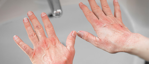 🚻 Aujourd’hui, c’est la Journée mondiale des toilettes.
82 % des Français jugent les sanitaires publics inadaptés.
Chez Essity, avec Tork, nous agissons pour une hygiène plus inclusive, accessible à toutes et tous.