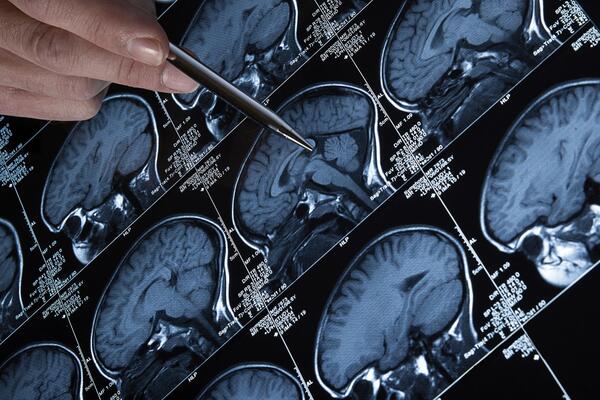 LORWEN108's tweet image. Most people think anxiety means:

“I’m screwed. My brain hates me.”

That’s not what’s happening.
Your brain is running outdated safety scripts.

If you grew up in chaos, criticism, or emotional neglect,
your nervous system learned ONE rule:
“Stay ahead of danger at all costs.”…