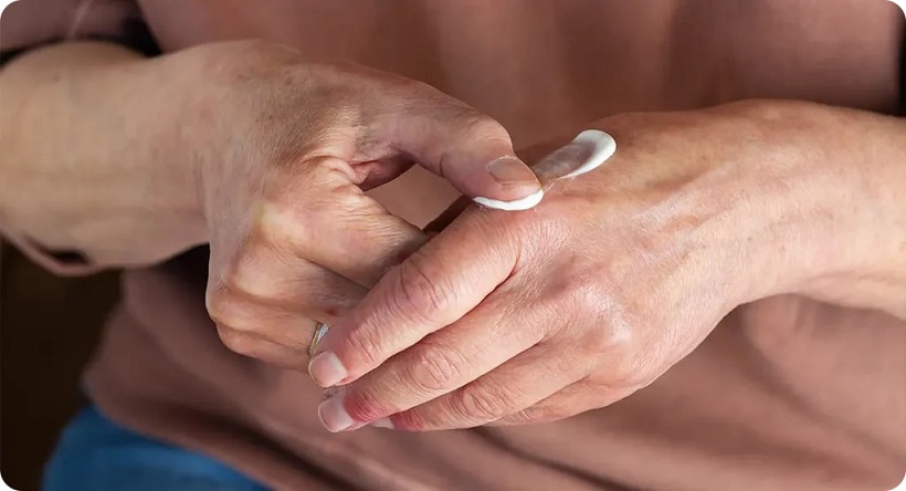 itstimholman's tweet image. Psoriasis research: what new treatments are on the horizon? tinyurl.com/ykupszz4 #psoriasis