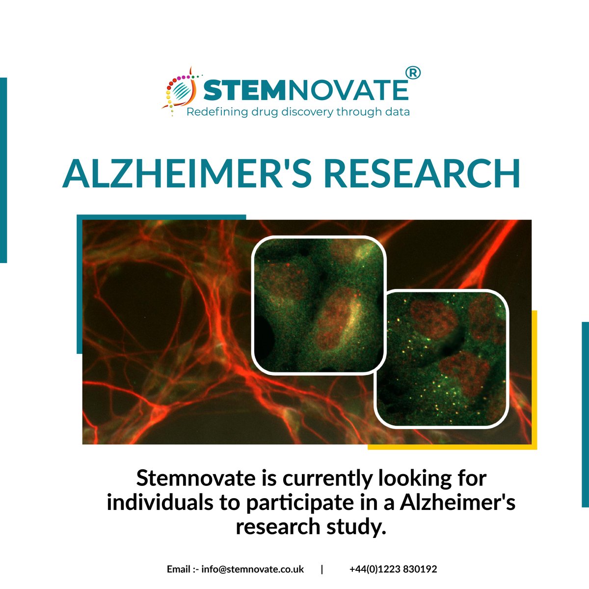 Unlock the future of neurodegenerative disease research! Discover how Stemnovate’s advanced models are paving the way for breakthroughs in Alzheimer’s disease. Explore more: hubs.ly/Q03TJmkT0 
#Neuroscience #DrugDiscovery #AlzheimersResearch #Innovation