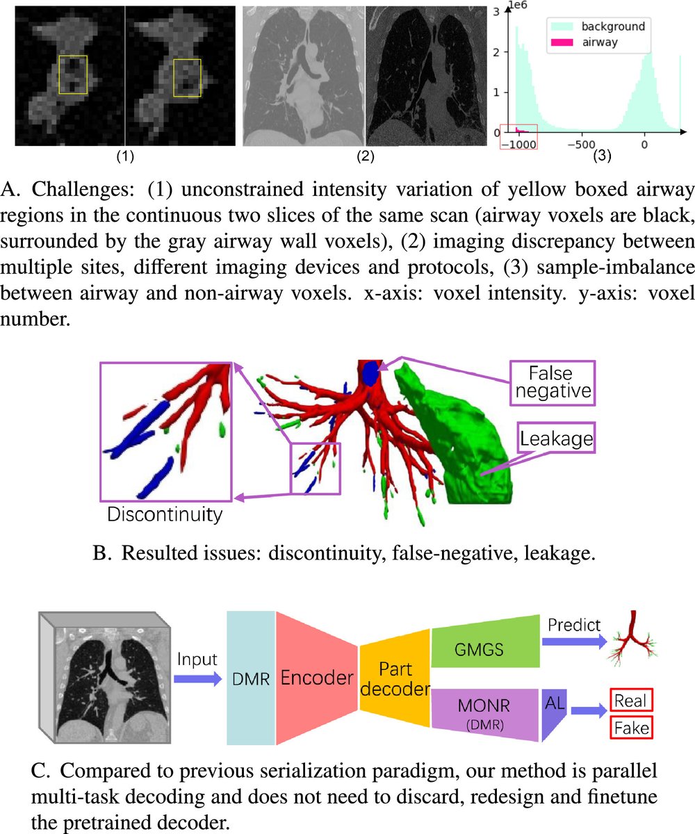 gyangMedIA's tweet image. Introducing DMGSA — a hybrid supervised–unsupervised framework for robust #airway #segmentation in #CT 🎯✨

Tested on lung cancer, COVID-19, and fibrosis datasets — DMGSA beats SOTA by a wide margin 🚀📊

lnkd.in/e269xiNs

#MedicalImaging #DeepLearning #MedicalAI #CTAI