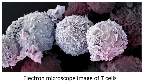 HarrySpoelstra's tweet image. T-cell exhaustion in COVID-19: what do we know?

🔥A very interesting literature review from Panama, an eye-opener for many, worth your time, especially for those minimisers😡! #LEONARDI_EFFECT

➡️T-cell exhaustion is a terminal state of immune dysfunction characterized by…