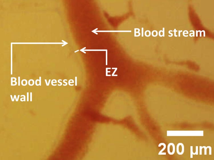 ProjectImpero's tweet image. Can sunlight charge your cells like a battery?

Light is bioactive. Mammals have evolved to use its photonic energy in ways much more sophisticated than mere photosynthesis.

Infrared light, for instance, can penetrate living tissue and impart enough energy on intracellular H2O…