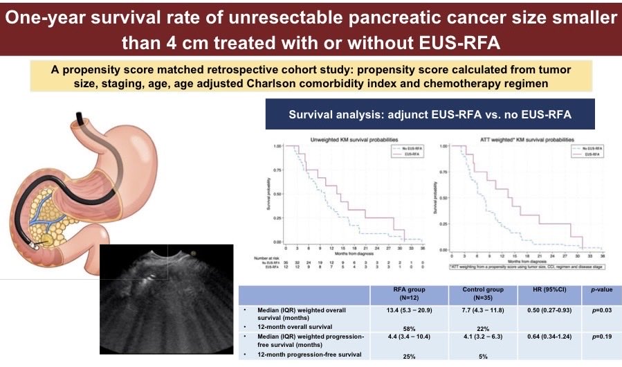 SChandanMD's tweet image. In honor of #PancreaticCancerAwarenessMonth

One-year survival rate of unresectable pancreatic cancer size 4 cm or smaller treated with or without EUS-RFA in Dec issue of @GIE_Journal &amp;amp; my accompanying editorial!

📄 tinyurl.com/2rdmzfra

🕵️‍♂️ tinyurl.com/2upn9zj2

#GITwitter