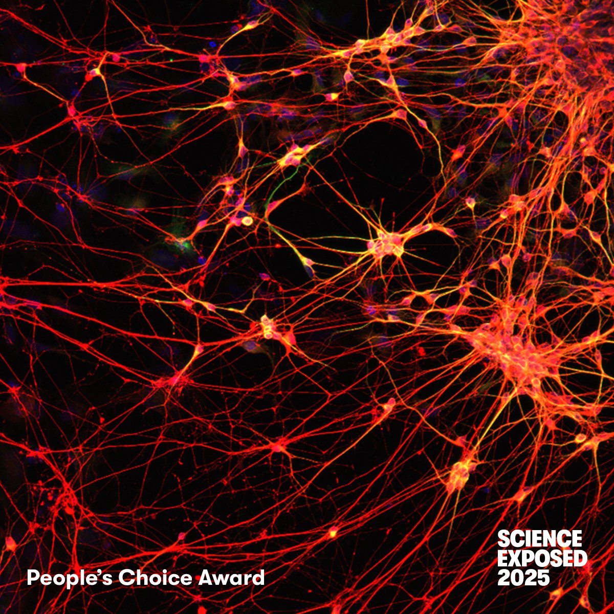 NSERC_CRSNG's tweet image. 📸🏆
The #ScienceExposed 2025 People’s Choice Award goes to the image [Synaptic sunset].

Congratulations to Jade Fisher from @UofRegina !

Find out what the image is about:
▶ tinyurl.com/3wc79h4k