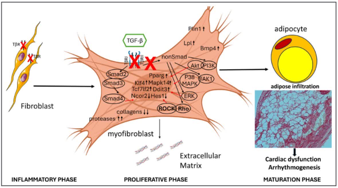 #ICYMI #OriginalResearch After a heart attack, fibroblasts can transform into fat cells via disrupted TGF-β signaling, driving lipomatous metaplasia—shedding new light on post-MI remodeling! ahajrnls.org/48kU3qL <a href="/IzabelaTuleta/">Izabela Tuleta</a> <a href="/EinsteinMed/">Albert Einstein College of Medicine - Official</a> <a href="/zhengdy/">D. Zheng</a>