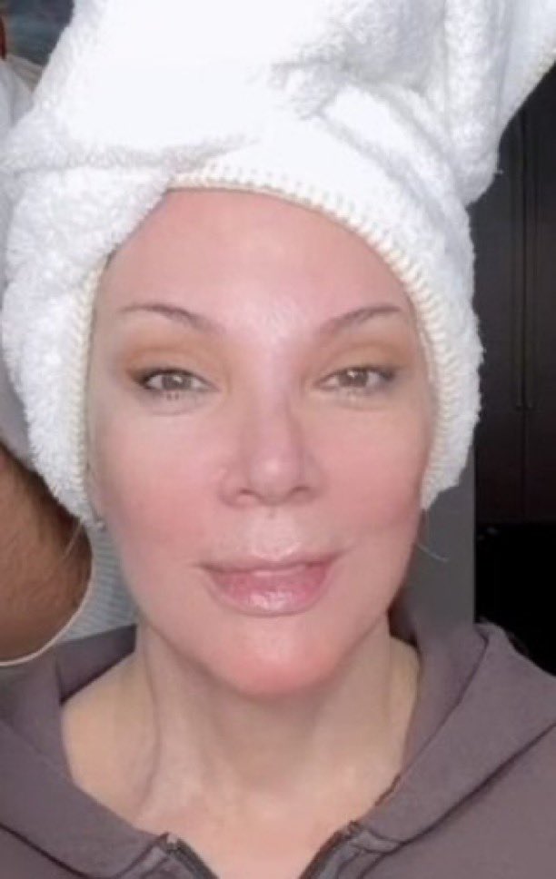 So, we're supposed to believe Kris Jenner just had surgery?