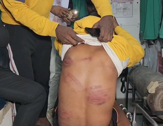 bstvlive's tweet image. उन्नाव : दही थाना पुलिस का अमानवीय चेहरा आया सामने

➡अधिवक्ता को थाने ले जाकर पट्टे और डंडो से पीटा 
➡हत्या के प्रयास के केस में जेल भेज रही थी पुलिस 
➡कोर्ट में हाजिर करने के दौरान वकील हुए लामबंद 
➡ACJM कोर्ट में वकीलों का घंटों चला हंगामा
➡पुलिस के साथ की धक्का-मुक्की और…