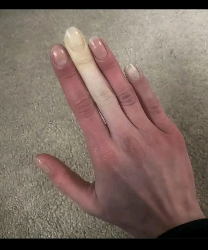 What can cause this?