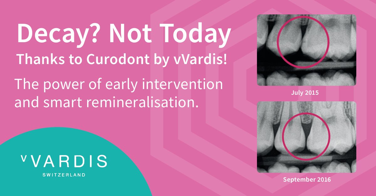 Kent_Express's tweet image. Aleady used in over 200,000 dental procedures, Curodont Repair from vVARDIS currently stands at the forefront of biomimetic dental science.

How can Curodont Repair benefit your practice? Here are 5 reasons how:

1️⃣ Quick and easy application-in less than 5 minutes
2️⃣ Easy…