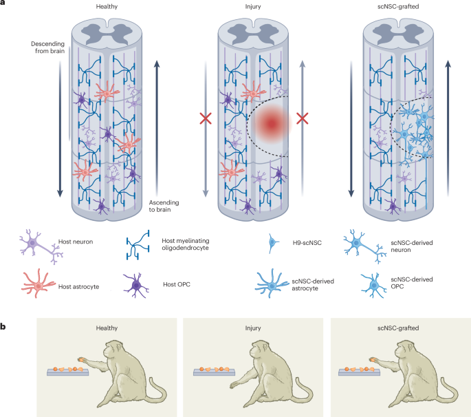 NatureBiotech's tweet photo. @ucsdneurodept @UCSanDiego @IcahnMountSinai @FAS_SFU Stem cells help restore hand function after spinal cord injury in monkeys #NBTNV https://t.co/WVP05QqcNv https://t.co/zoEn1HbmwZ