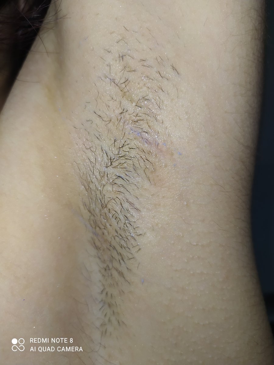 cinocincin1412's tweet image. Killarimi seviyorum ve sayomiyle cektim sikinti var mi krdsm?