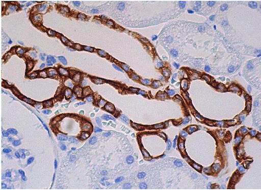 CosmoBio_JPN's tweet image. 🧪Pick UP！組織染色🌈
マウスIgGκ結合タンパク質

ウェスタンブロッティングや免疫染色での使用におすすめの、
マウスIgGのκ軽鎖に結合するタンパク質とHRPのコンジュゲートです🧪✨

✅二次抗体の代替として使用可能
✅ロット間差ほぼなし
✅高特異性でシグナルUP＆バックグラウンド低減…