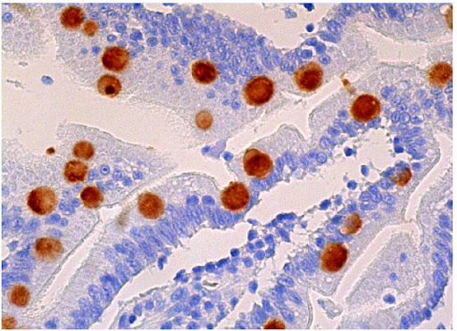 CosmoBio_JPN's tweet image. 🧪Pick UP！組織染色🌈
マウスIgGκ結合タンパク質

ウェスタンブロッティングや免疫染色での使用におすすめの、
マウスIgGのκ軽鎖に結合するタンパク質とHRPのコンジュゲートです🧪✨

✅二次抗体の代替として使用可能
✅ロット間差ほぼなし
✅高特異性でシグナルUP＆バックグラウンド低減…