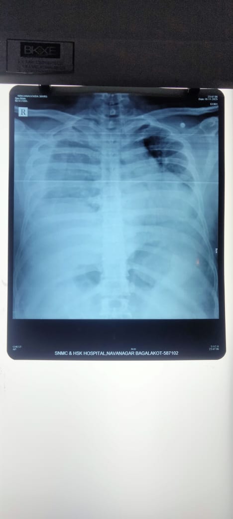 Anyone awake wt do u think this is , Fast is it atelectasis