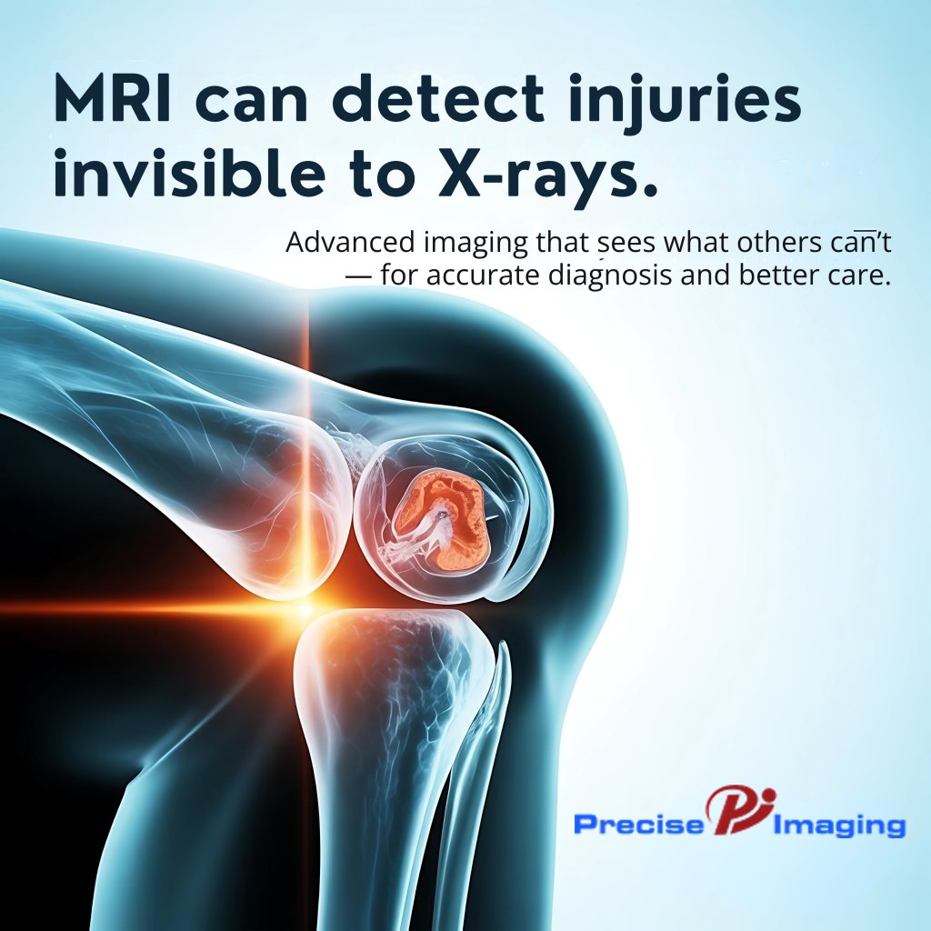 PreciseImaging's tweet image. 🩻➡️🧲 See Beyond the Surface X-rays can miss what MRIs reveal. With Precise Imaging, advanced MRI technology detects injuries invisible to X-rays — giving doctors the clarity needed for accurate diagnosis and better care. ✨ Because your health deserves precision.