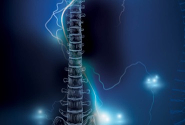 painmednews's tweet image. 💡 New SCS tech could change chronic pain care. EVOKE study shows durable relief and improved function with long-term spinal cord stimulation painmedicinenews.com/a/pDIBAA/t #PainManagement #Neuromodulation