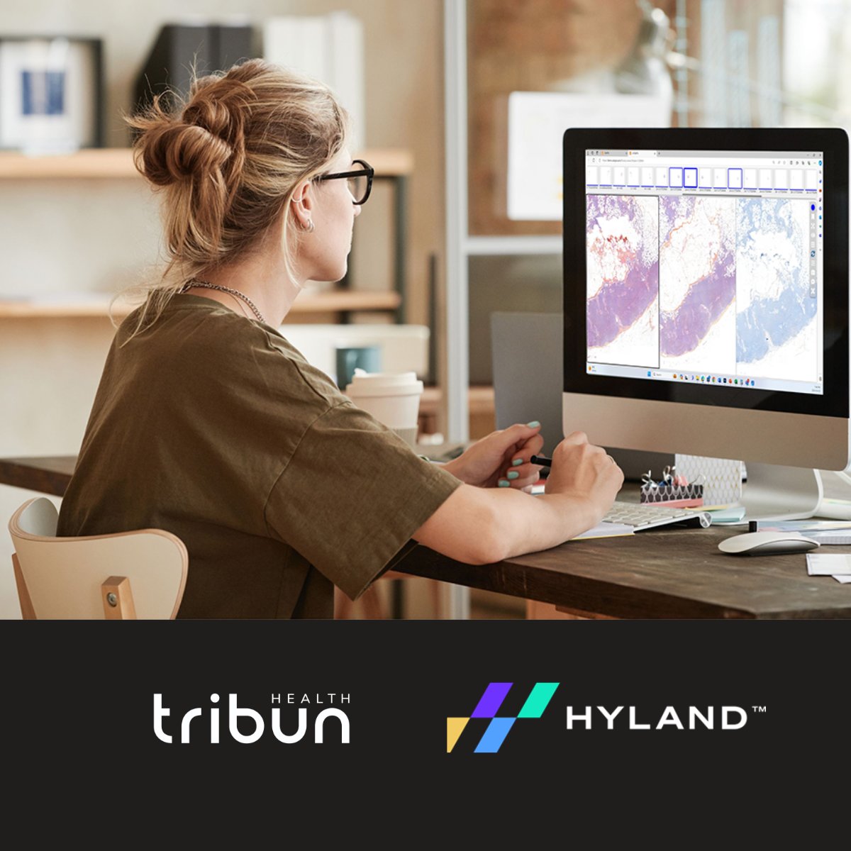 Tribun_health's tweet image. We’re partnering with Hyland to advance intelligent pathology workflows. 🧬CaloPix® + Hyland’s ecosystem brings smarter image access, secure workflows, and AI-ready diagnostics to pathology teams. 
Read the full press release 👉 hubs.la/Q03TL-Yt0
#DigPath #RSNA2025