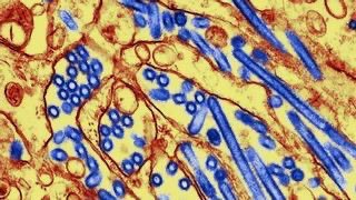 🇺🇸 | Confirman el primer contagio humano de la variante H5N5 de gripe aviar en Estados Unidos:

Por primera vez, un hombre del estado de Washington se ha infectado con una cepa de gripe aviar detectada anteriormente solo en animales y nunca antes en humanos.

El hombre,