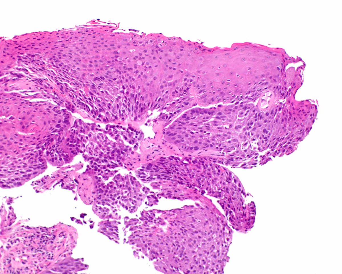 Modern Pathology tweet media
