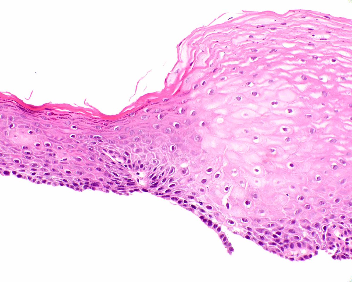 Modern Pathology tweet media