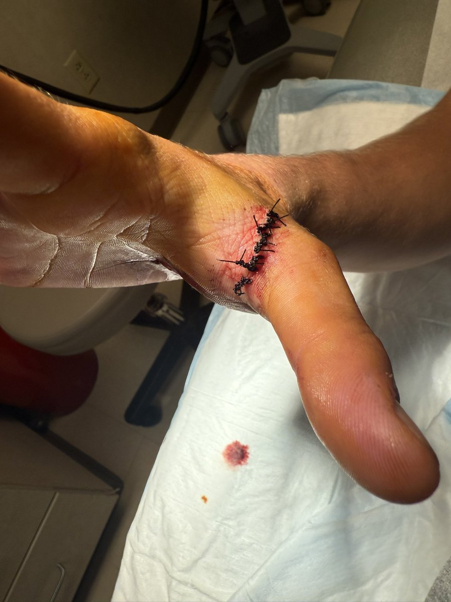 Sam Frieze tweet media