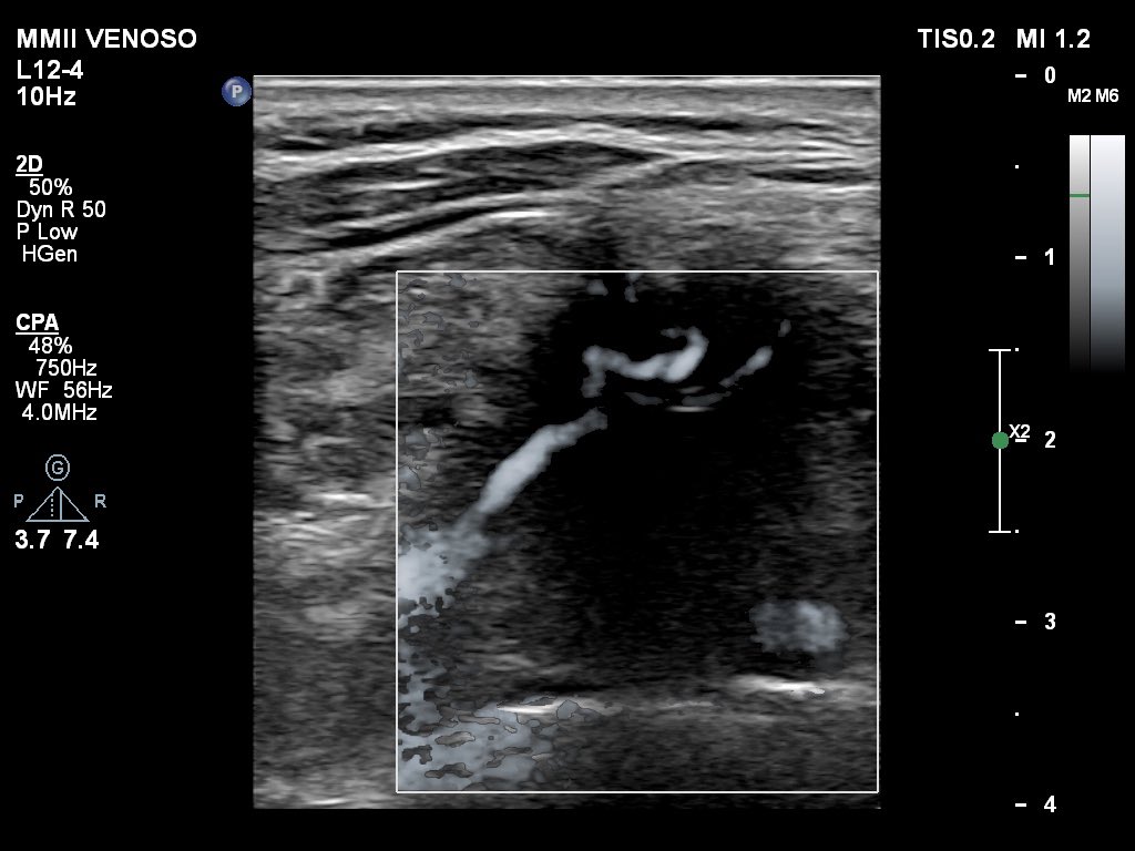 Marcos A. P. Borges, MD 🇧🇷 tweet media