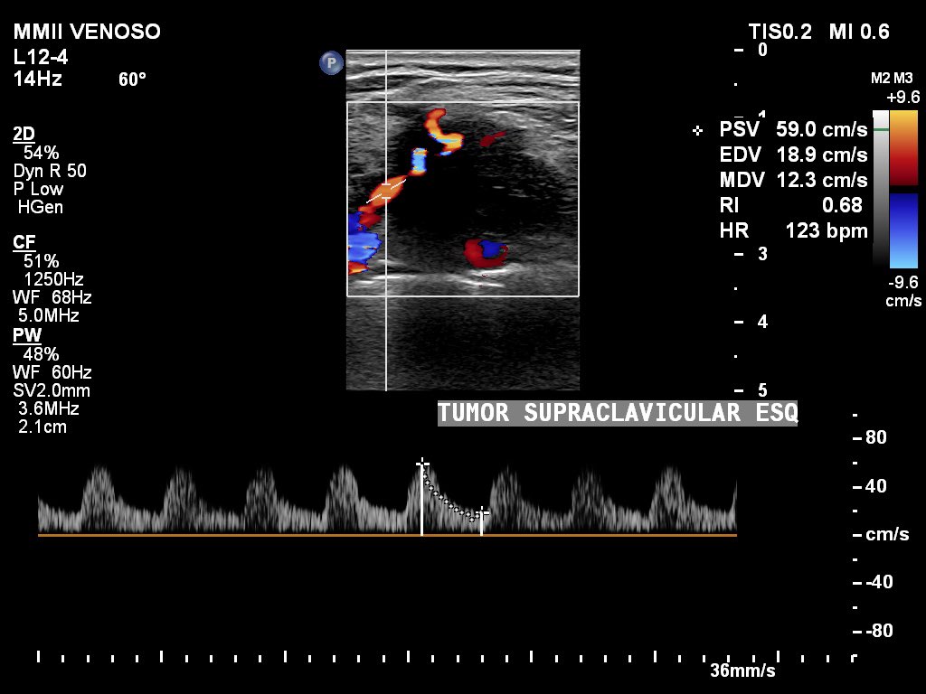 Marcos A. P. Borges, MD 🇧🇷 tweet media
