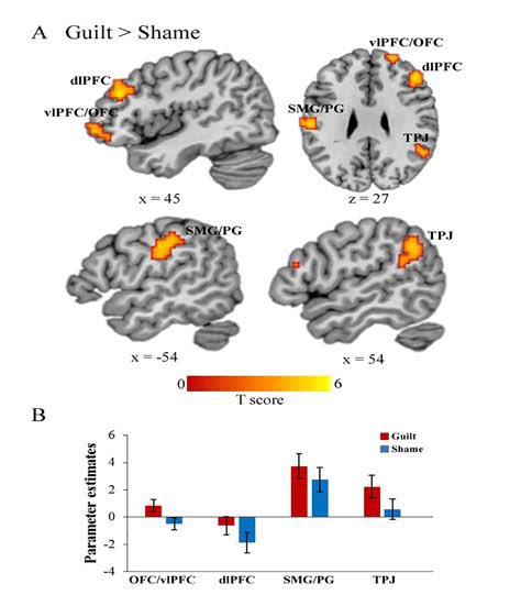 uberboyo's tweet image. The neuroscience of guilt is one of the most brutal things I’ve ever researched

There is no objective quality to our conscience

When we experience guilt we don’t ponder abstract truths or moral imperatives

Our salience networks (pMFC, ACC) use deep primal emotions to give us…