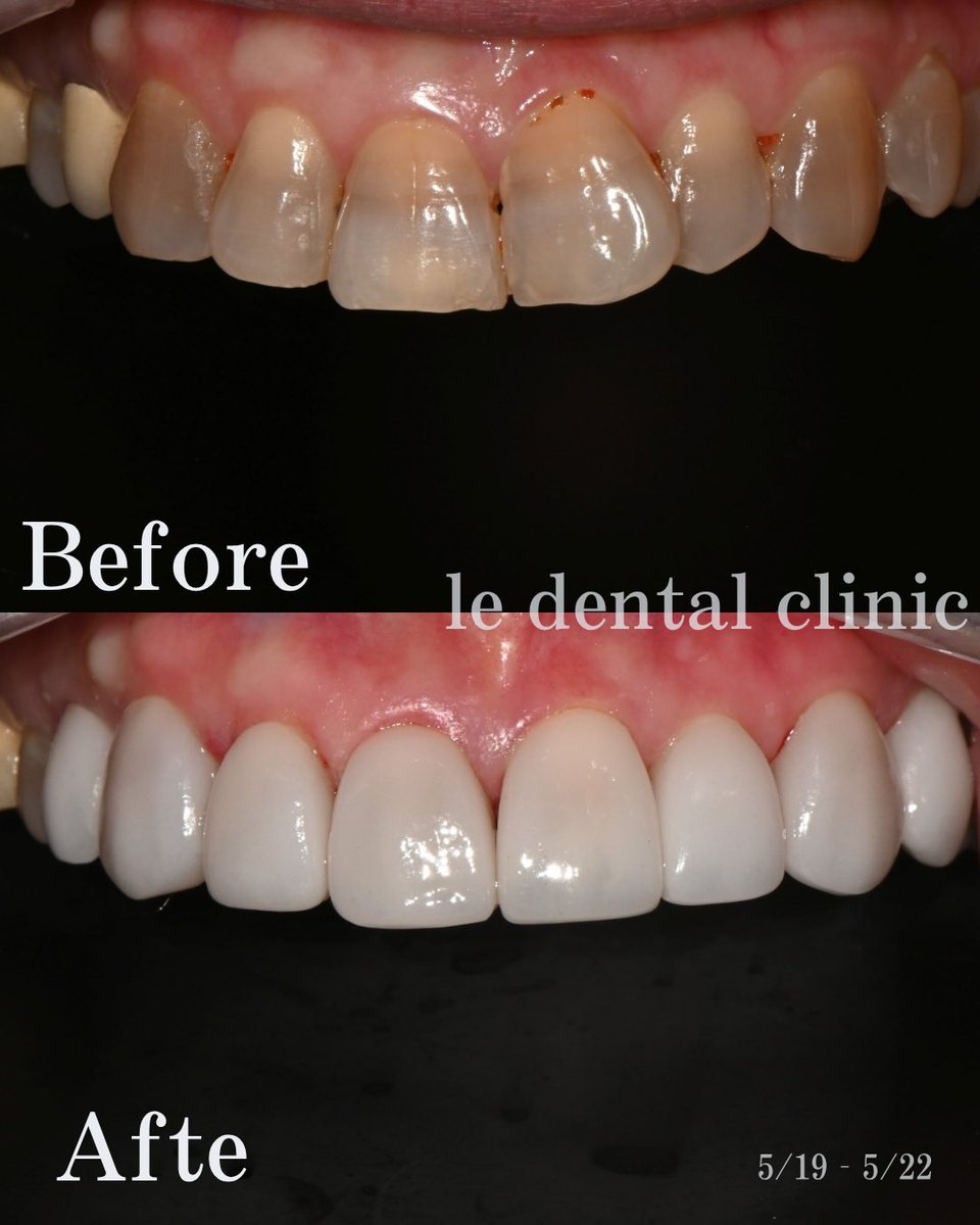 【公式】ル歯科 カンナム歯医者(le:dental clinic) tweet media