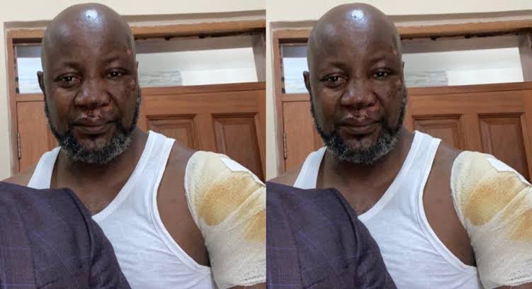 isaacmukiibiSnr's tweet image. The motorbike betrayed us for sure