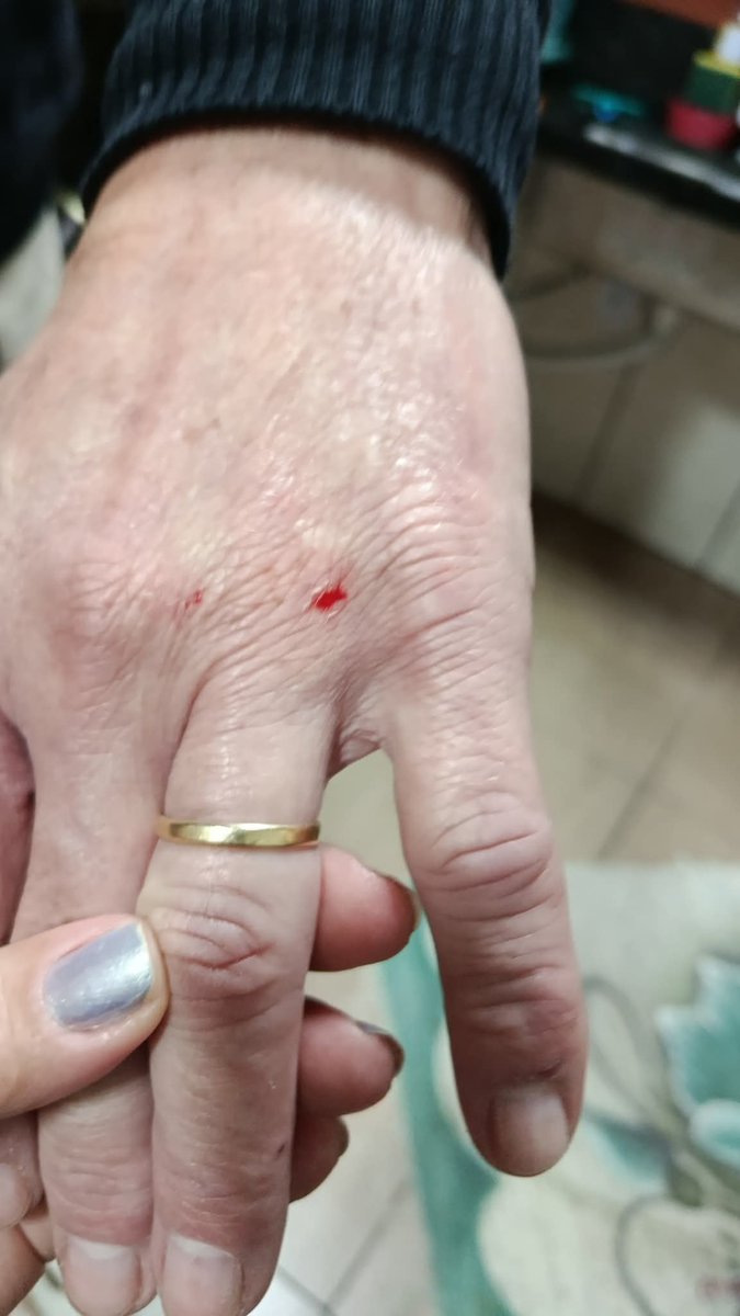 FabiBorba's tweet image. No dia que levamos foi outro dia de terror. Ele falava absurdos para o pai e gravava tudo para postar aqui se fazendo de vítima. Descobrimos tanta coisa. Ele comprava remédios com receita falsa. Imprimia aqui em casa mesmo. Fumava diaa e noite. Dormia 24h. Machucou o pai.