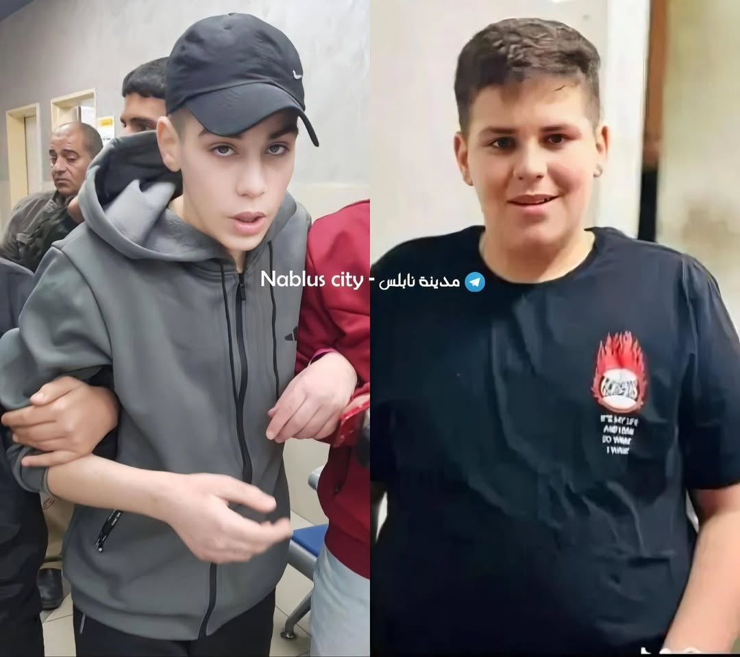 abierkhatib's tweet image. This is 16 yo Mohammed Ahmad Hamad after spending 13 months in Israeli detention.
 
Barbaric monsters