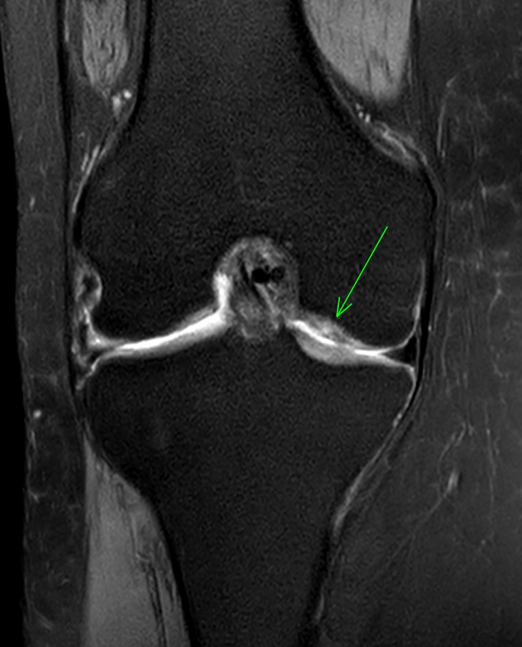 JuanMiranda tweet media