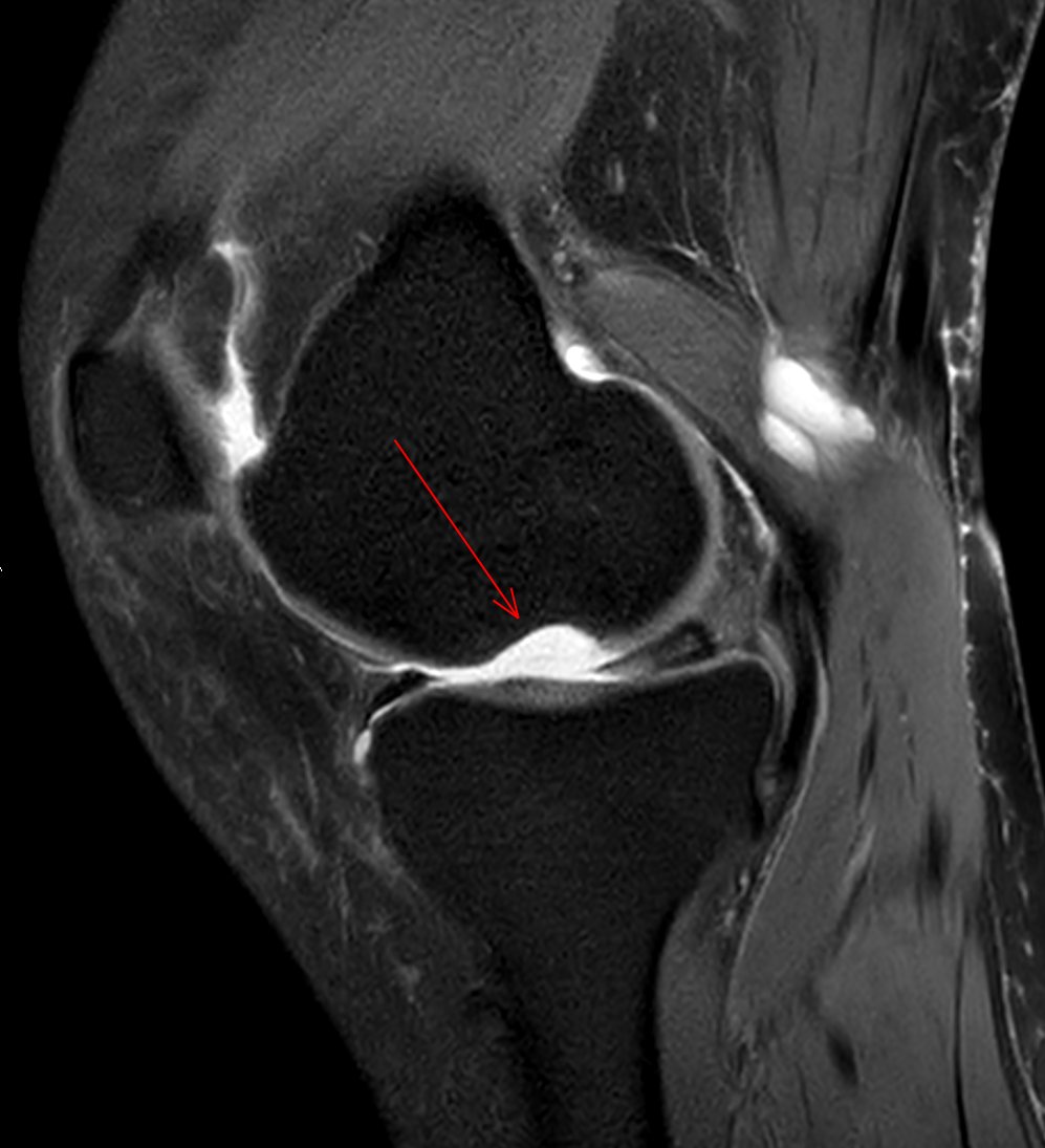 JuanMiranda tweet media