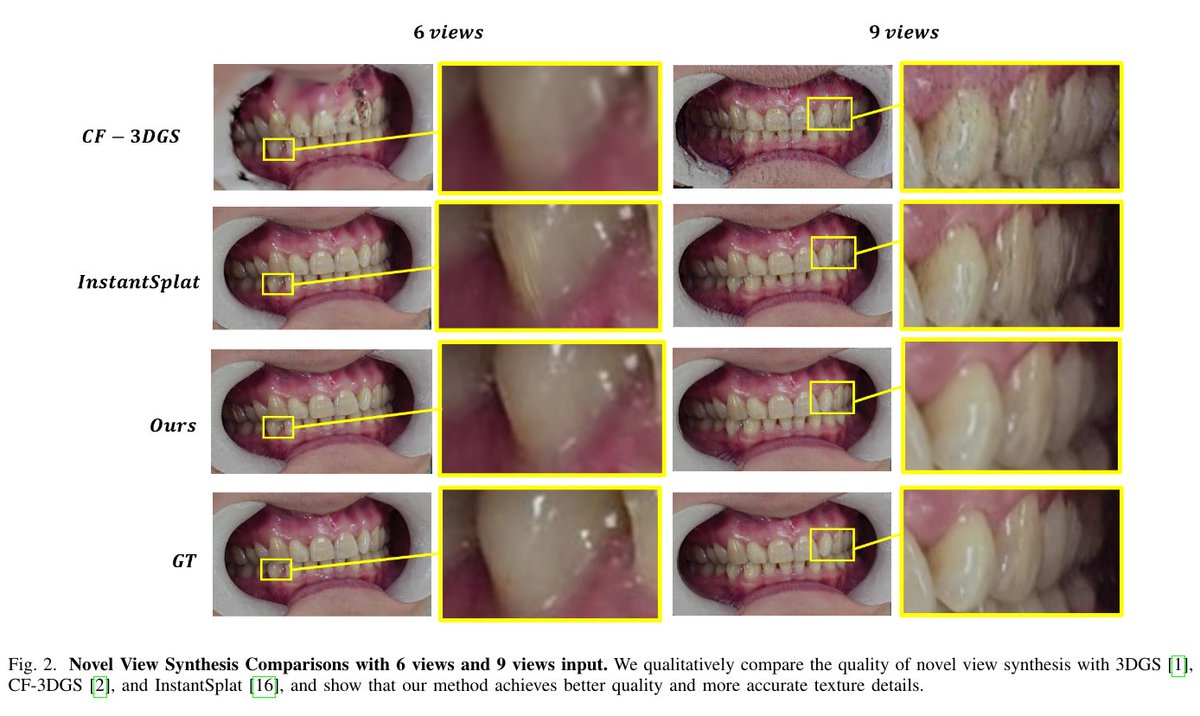 看来我错了。今天发表了两篇基于3DGS技术的牙科领域论文：

 Dental3R：基于稀疏视图照片的口内三维重建的几何感知配对

轮廓到轮廓配准：将口内扫描模型与头颅侧位X光片对齐