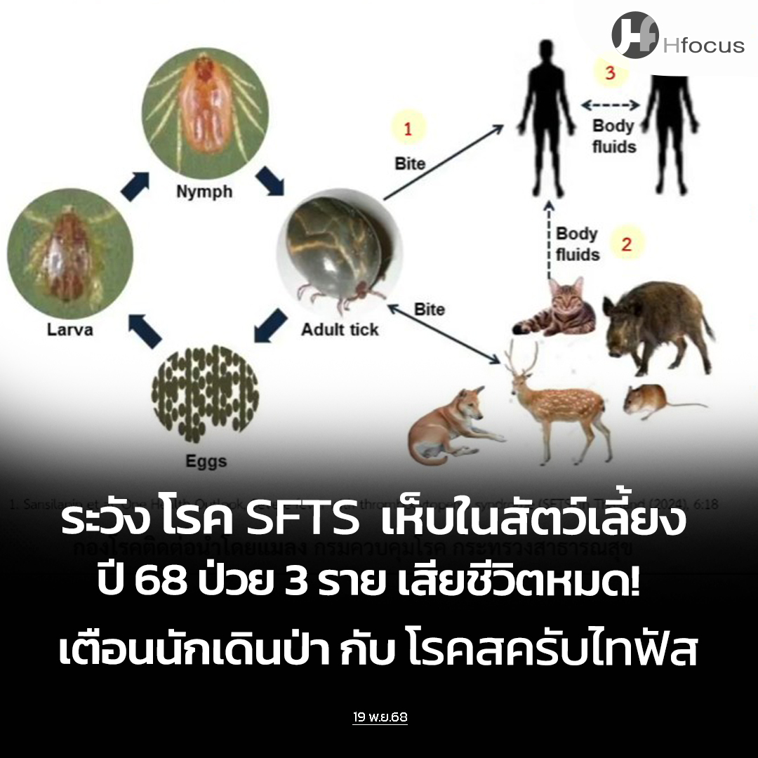 hfocusnews's tweet photo. ระวัง โรค SFTS เห็บในสัตว์เลี้ยง ปี 68 ป่วย 3 รายเสียชีวิตหมด! เตือนโรคสครับไทฟัส นักเดินป่า

https://t.co/nvhNiP6CC5

#Hfocus #โรคSFTS #โรคสครับไทฟัส #โรคไข้รากสาดใหญ่ #นักเดินป่า #เกษตรกร #สัตว์เลี้ยง #เห็บ https://t.co/E3aoQ39RRT