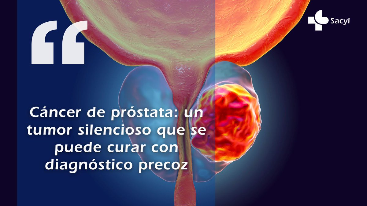 Salud_JCYL's tweet image. El #CáncerDePróstata es silencioso: los síntomas aparecen tarde 

El Dr. Marcos Cepeda, jefe de Urología del Hospital Universitario Río Hortega, insiste: PSA desde los 50 (antes si hay riesgo). La cirugía robótica permite más precisión y menos secuelas 

saludcastillayleon.es/HRHortega/es/n…