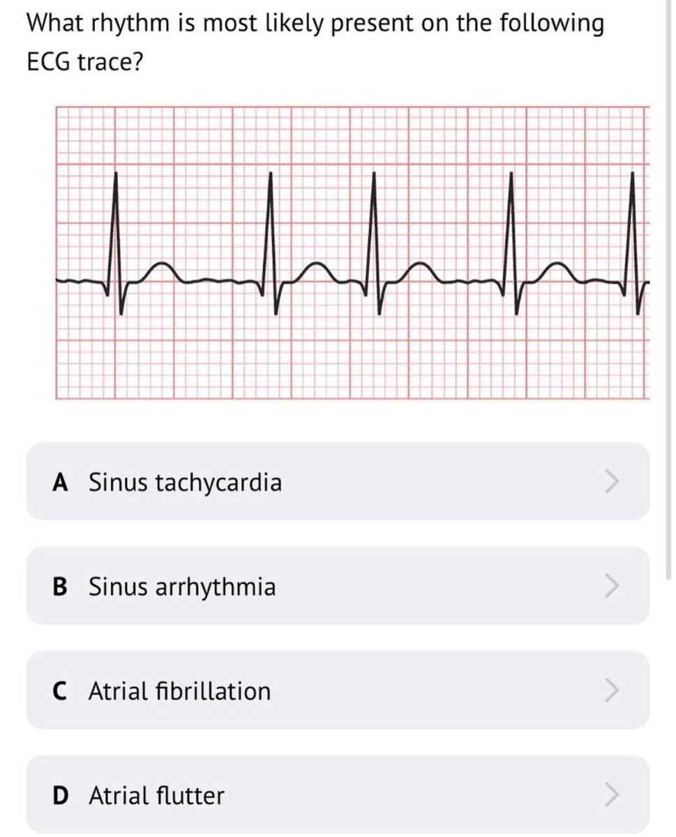 doctors_squad's tweet image. What rhythm is most likely present on the following ECG trace?