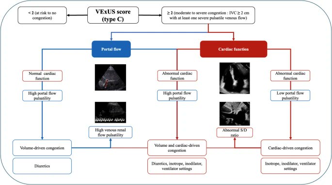 🚨New in #CritCare
VExUS score: optimizing its use in perioperative and critical care management
doi.org/10.1186/s13054…
#CriticalCare #ICU #VExUS
